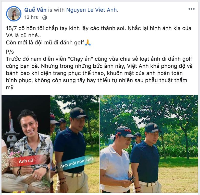 Quế Vân thanh minh cho nhan sắc Việt Anh sau khi dao kéo bằng hình ảnh hiện tại gây hoang mang không kém-2