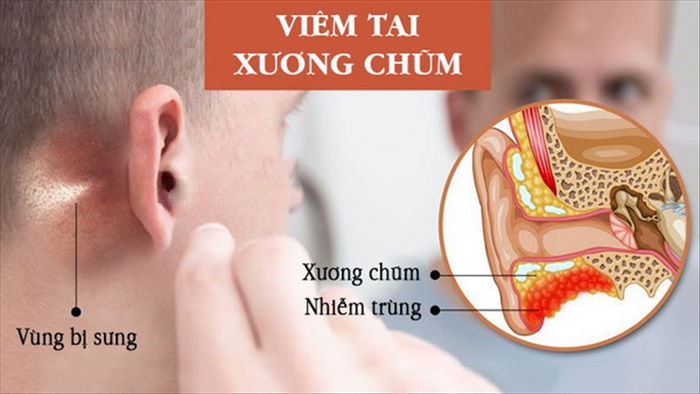 Xương chũm nằm sâu bên trong tai.