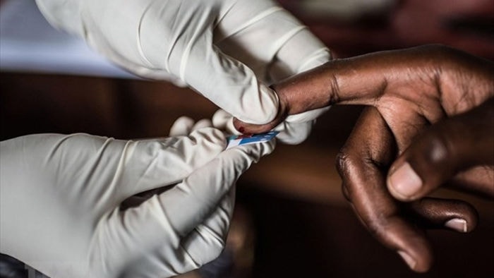Bước đột phá tiềm năng trong điều trị căn bệnh HIV/AIDS hình ảnh 1 Buoc dot pha tiem nang trong dieu tri can benh HIV/AIDS hinh anh 1