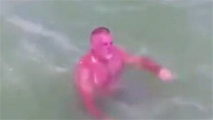Người đàn ông cháy nắng khủng khiếp bơi giữa đám cá đuối trên biển Florida - 1