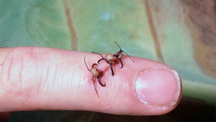 Loài kiến háu ăn nhất thiên nhiên: một ngày săn 500.000 con mồi, hàm răng nối lành được vết thương của người - Ảnh 3.
