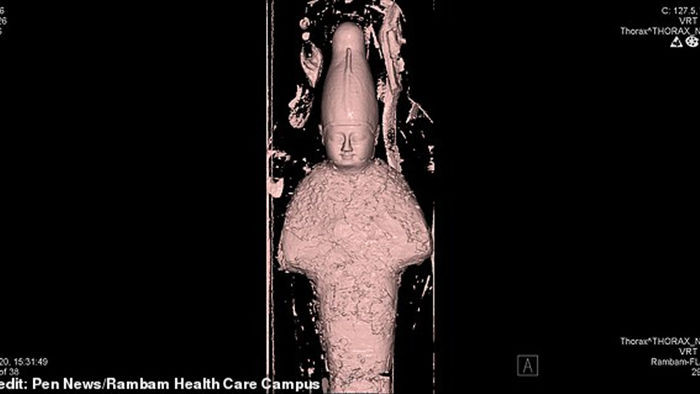 Các nhà khoa học không thể tin vào mắt mình khi nhìn ảnh chụp CT xác ướp 3000 tuổi, bên trong có gì vậy? - Ảnh 2.