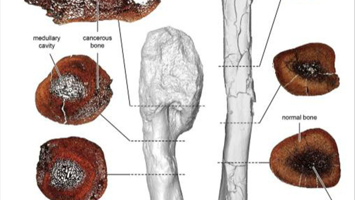Tìm thấy khối u ác tính 76 triệu năm trong xương khủng long - Ảnh 1.