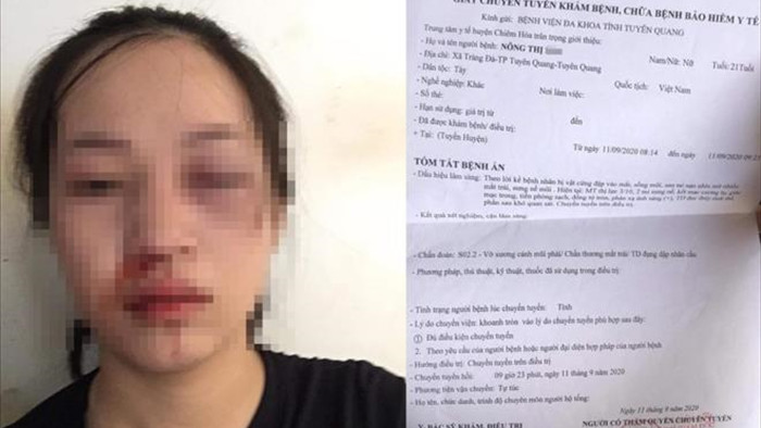 CSGT bị tố vụt gậy vào mặt người phụ nữ đi xe máy: Công an Tuyên Quang lên tiếng - 1