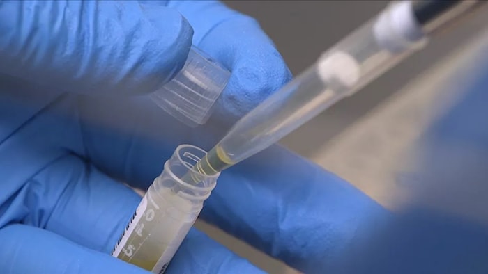 Phát hiện biến chủng virus SARS-CoV-2 có khả năng lây lan mạnh hơn? - 1 Phát hiện biến chủng virus SARS-CoV-2 có khả năng lây lan mạnh hơn? - 1