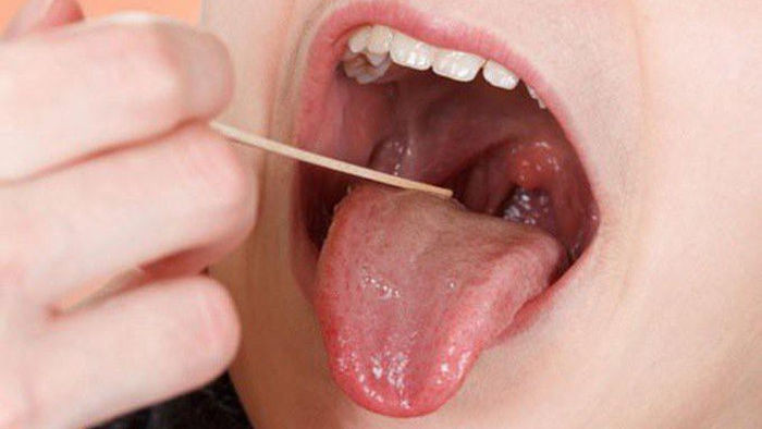 Nguy cơ ung thư vòm họng từ thói quen ăn dưa muối xổi - 3