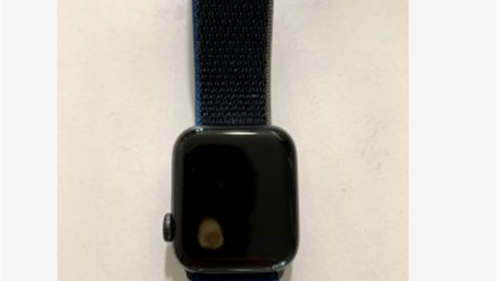 Apple Watch SE gặp lỗi quá nhiệt, khiến người dùng bị bỏng và làm hỏng màn hình - Ảnh 3. Apple Watch SE gặp lỗi quá nhiệt, khiến người dùng bị bỏng và làm hỏng màn hình - Ảnh 3.