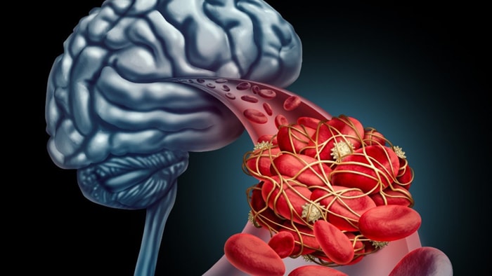 Scientists-Devise-New-System-to-Monitor-Brain-Bloo.jpg Scientists-Devise-New-System-to-Monitor-Brain-Bloo.jpg