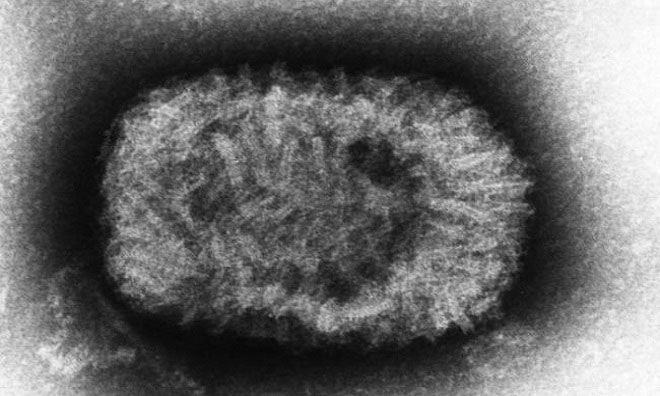 Virus đậu mùa