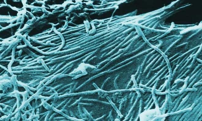 Virus Ebola