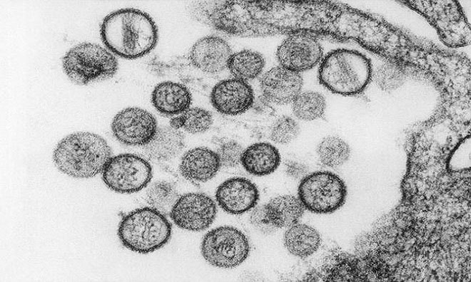 Virus Hanta