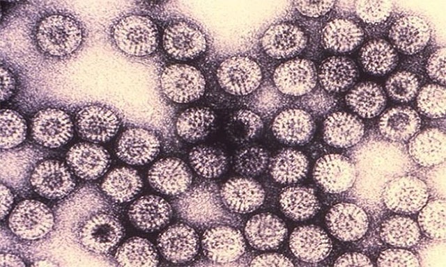 Virus rota