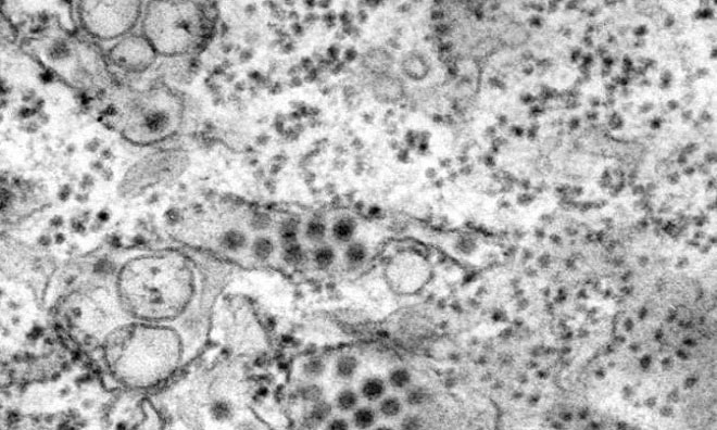 Virus sốt xuất huyết