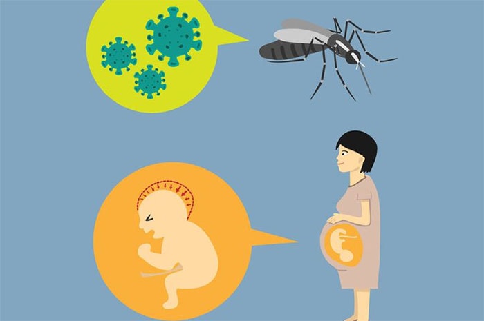 Virus Zika