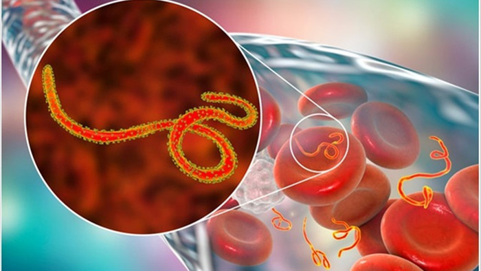 Virus Ebola có thể ẩn náu nhiều năm bên trong cơ thể con người - 1