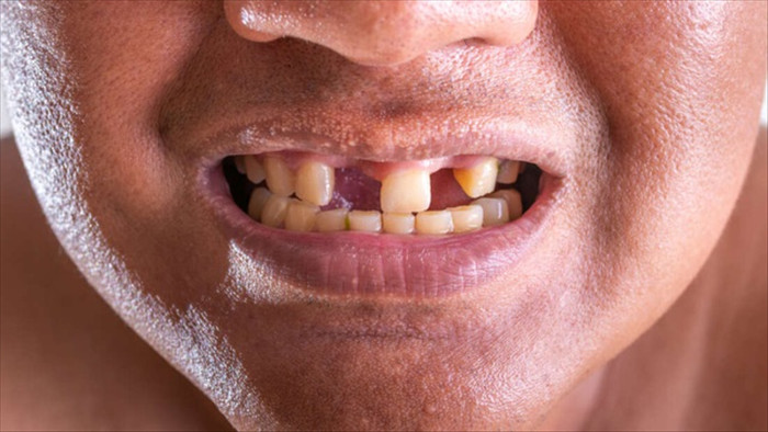 Các nhà khoa học tìm ra cách có thể giúp con người mọc lại răng - 1