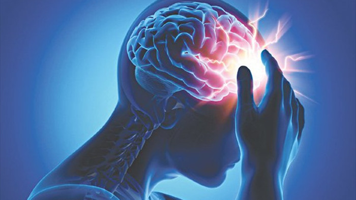 Nghiên cứu mới: Covid-19 ảnh hưởng nghiêm trọng tới não, dễ gây đột quỵ - 1