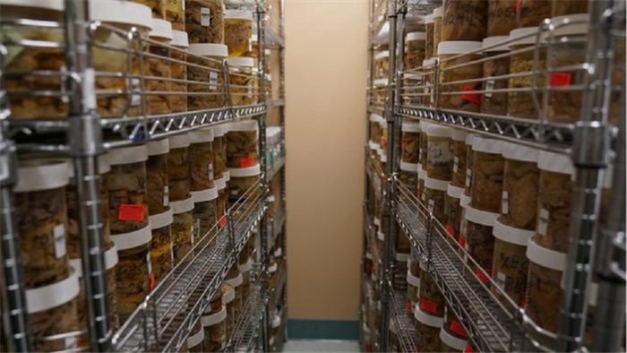 Hình ảnh lưu trữ não người tại một ngân hàng não ở Mỹ - 2
