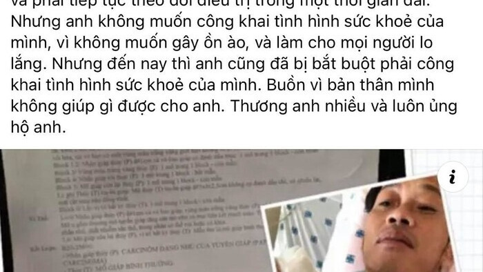 Nhiều sao Việt chia sẻ khi biết Hoài Linh bị ung thư tuyến giáp - 3
