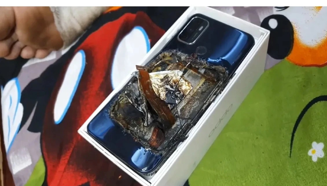 Smartphone phát nổ trong túi quần khiến chủ nhân bị thương nặng - 1 Smartphone phát nổ trong túi quần khiến chủ nhân bị thương nặng-1