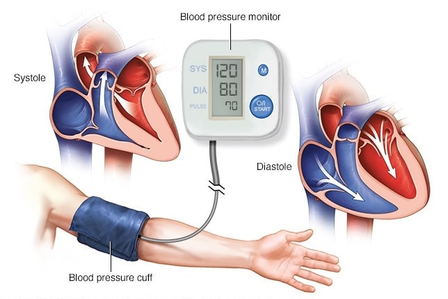 Bệnh nhân tăng huyết áp cần làm gì trong mùa Covid-19 - Ảnh 1. Bệnh nhân tăng huyết áp cần làm gì trong mùa Covid-19 - Ảnh 1.
