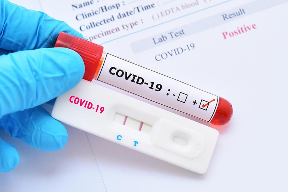 Dịch COVID-19 với bệnh nhân ung thư tiết niệu - Ảnh 3. Dịch COVID-19 với bệnh nhân ung thư tiết niệu - Ảnh 3.