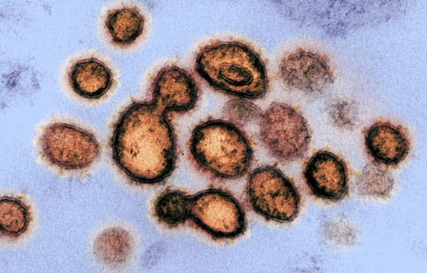 Phát hiện các virus cổ đại bị đóng băng 14.400 năm chưa từng được biết đến - Ảnh 1.