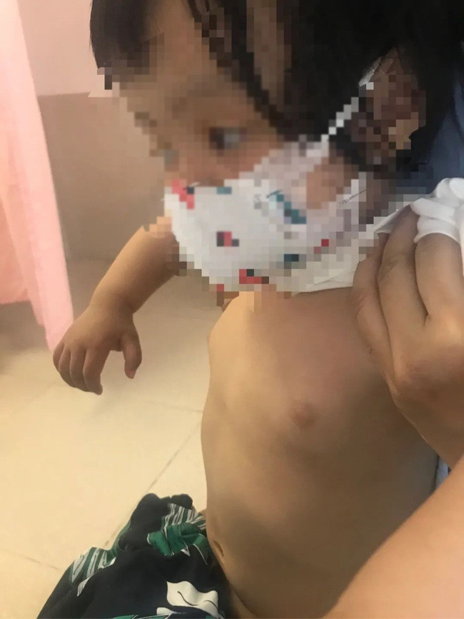 Thấy con gái mới 2 tuổi đã phát triển ngực, bà mẹ hốt hoảng cho con đi khám và được bác sĩ giải thích thế này-1