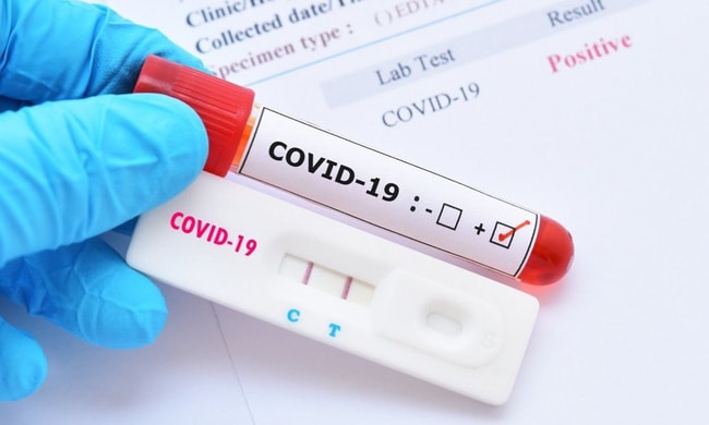 Cần biết: 16 loại test nhanh kháng nguyên SARS-CoV-2 được Bộ Y tế cấp phép - Ảnh 1. Cần biết: 16 loại test nhanh kháng nguyên SARS-CoV-2 được Bộ Y tế cấp phép - Ảnh 1.