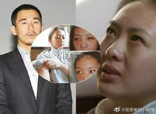 Bênh vực Trương Triết Hạn, chồng một nữ diễn viên có tiếng bị 'cấm ngôn' trong đêm, quá khứ đổi tình lấy vai diễn của vợ cũng bị 'đào' lại 3