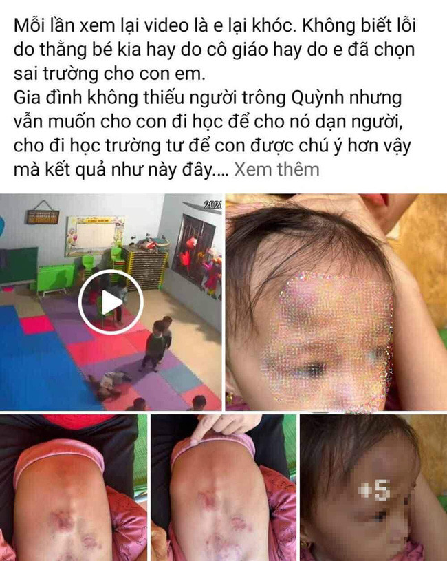 Bé gái 2 tuổi bị bạn đánh dã man trong lớp tại Bắc Giang: Phụ huynh có nên dạy con cách tự vệ từ bé?-1