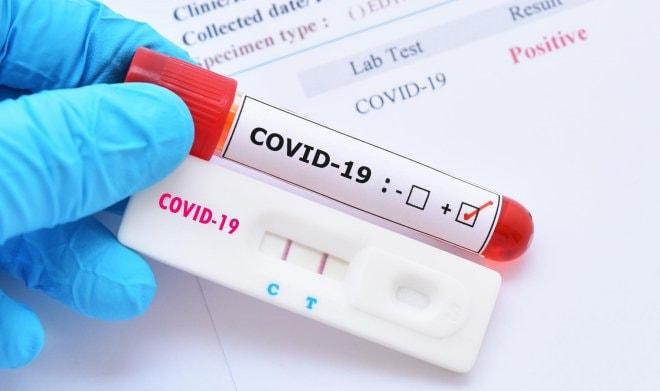 Bộ Y tế: Người chưa tiêm đủ liều vaccine COVID-19 ở vùng dịch về phải cách ly 14 ngày; xét nghiệm 3 lần - Ảnh 1. Bộ Y tế: Người chưa tiêm đủ liều vaccine COVID-19 ở vùng dịch về phải cách ly 14 ngày; xét nghiệm 3 lần - Ảnh 1.