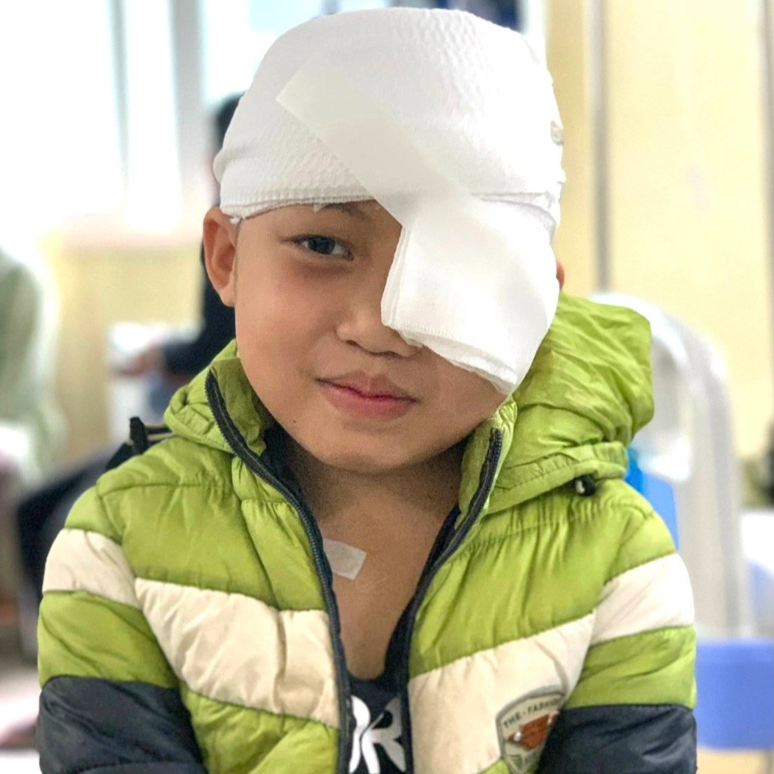 Cậu bé 8 tuổi mang khối u máu khủng sắp vỡ ở mắt - 2