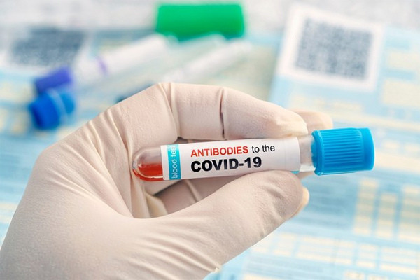 Các nước nghèo được miễn phí bản quyền xét nghiệm kháng thể Covid-19