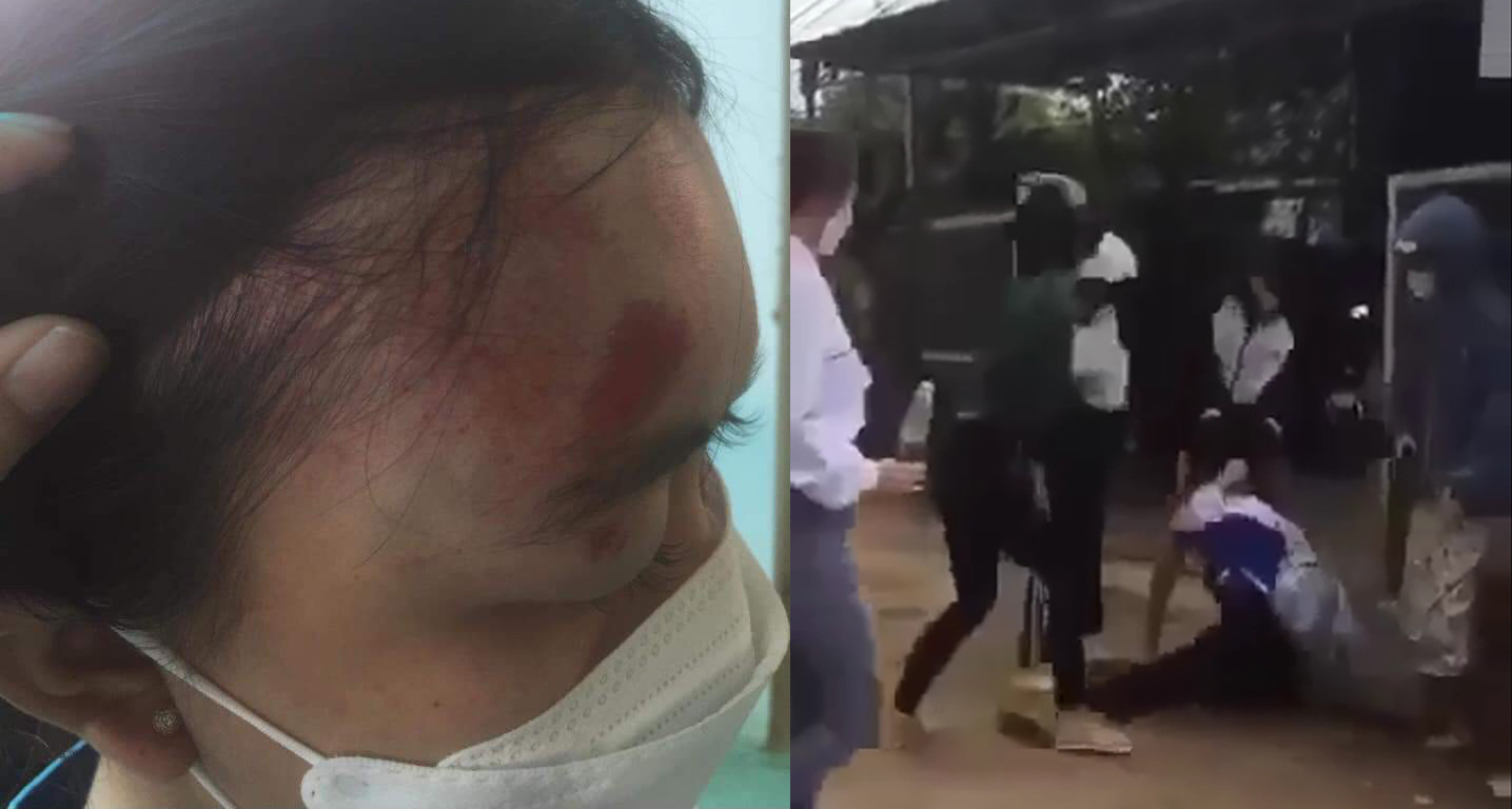 Lâm Đồng: Nữ sinh lớp 11 bị 6 người đánh - 1