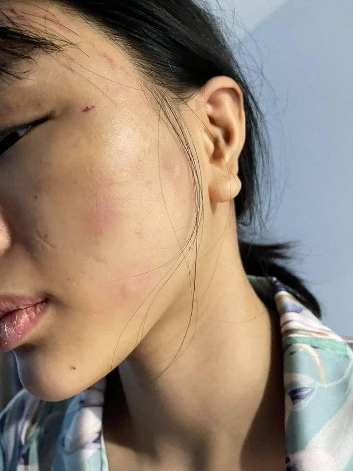 SỐC: Siêu mẫu Khả Trang bị bạo hành thân tàn ma dại-8