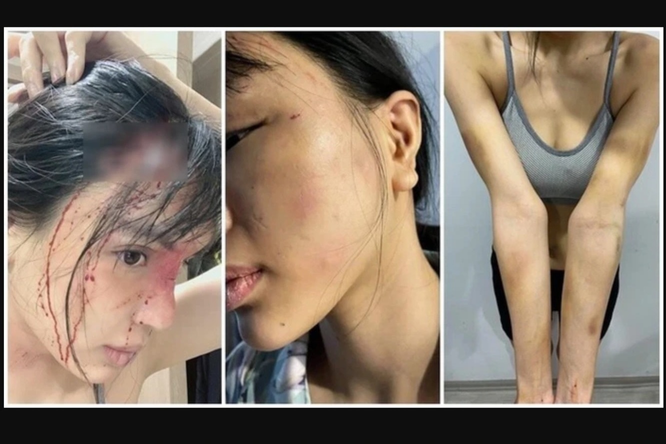 Công an điều tra nghi vấn siêu mẫu Khả Trang bị bạn trai bạo hành dã man - 1 Công an điều tra nghi vấn siêu mẫu Khả Trang bị bạn trai bạo hành dã man - 1