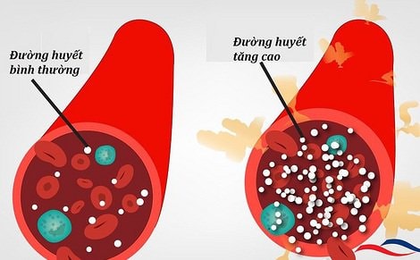 Những loại thực phẩm giúp kiểm soát đường huyết tốt người bệnh đái tháo đường nên ăn mỗi ngày - Ảnh 2.