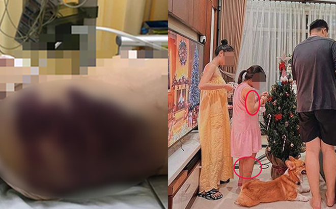 Vụ bé gái bị bạo hành đến tử vong: Hà Anh xin lỗi vì hoài nghi mẹ cháu bé - 2