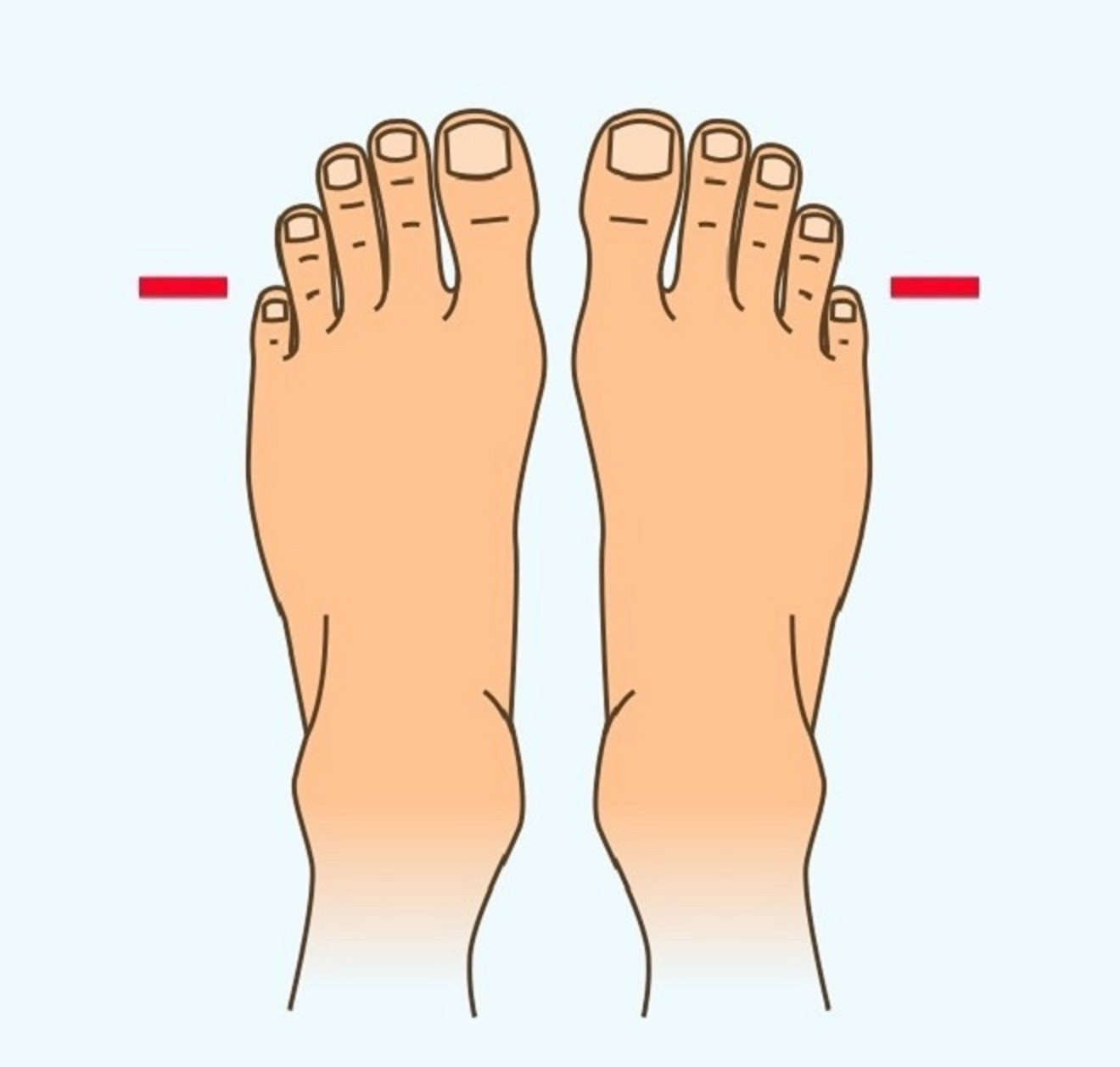 Trắc nghiệm: Đoán tính cách của bạn qua hình dạng ngón chân - 4