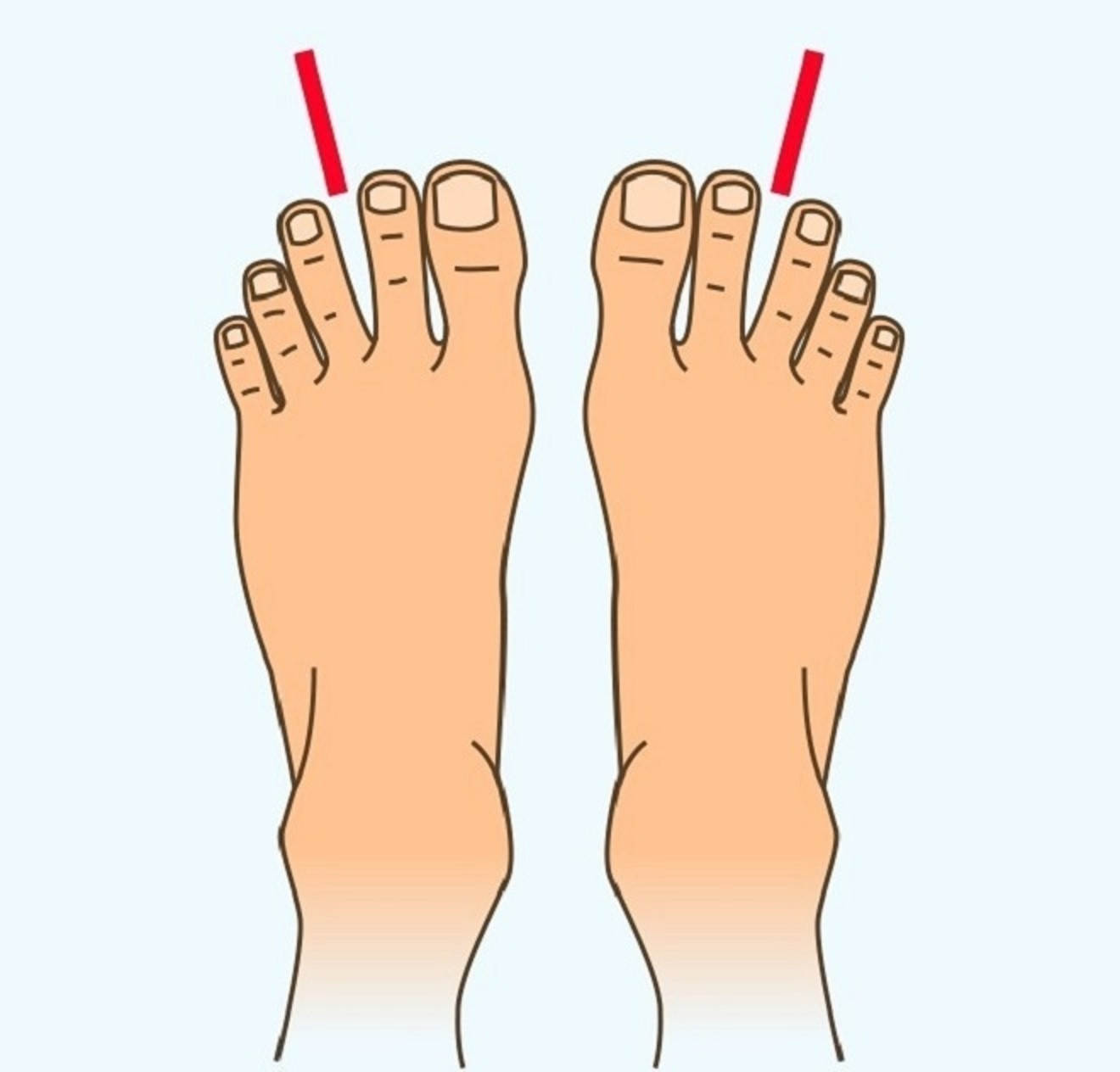 Какие бывают пальцы ног. Указательный палец на ноге.
