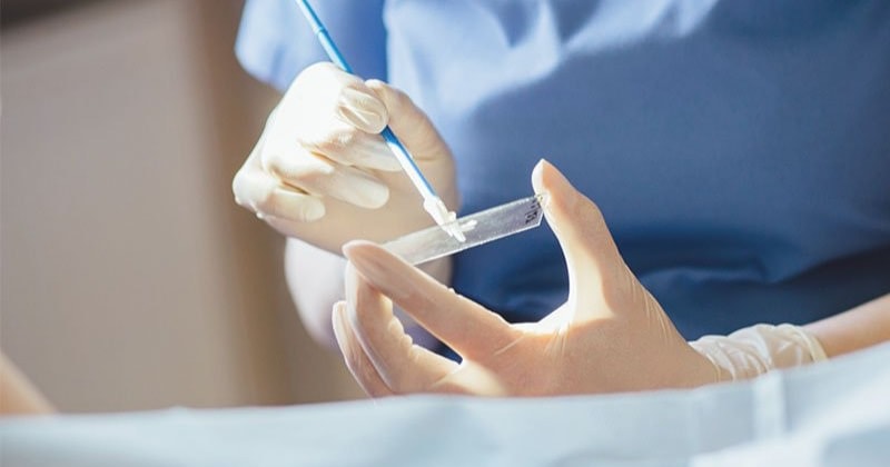 Bao lâu nên tầm soát ung thư cổ tử cung? - 1 Bao lâu nên tầm soát ung thư cổ tử cung? - 1