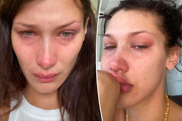 Đăng nhiều ảnh khóc lên mạng xã hội, siêu mẫu Bella Hadid muốn nói điều gì? - 1
