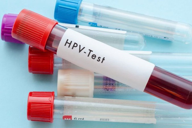 Nhiễm HPV có chữa được không? - 1