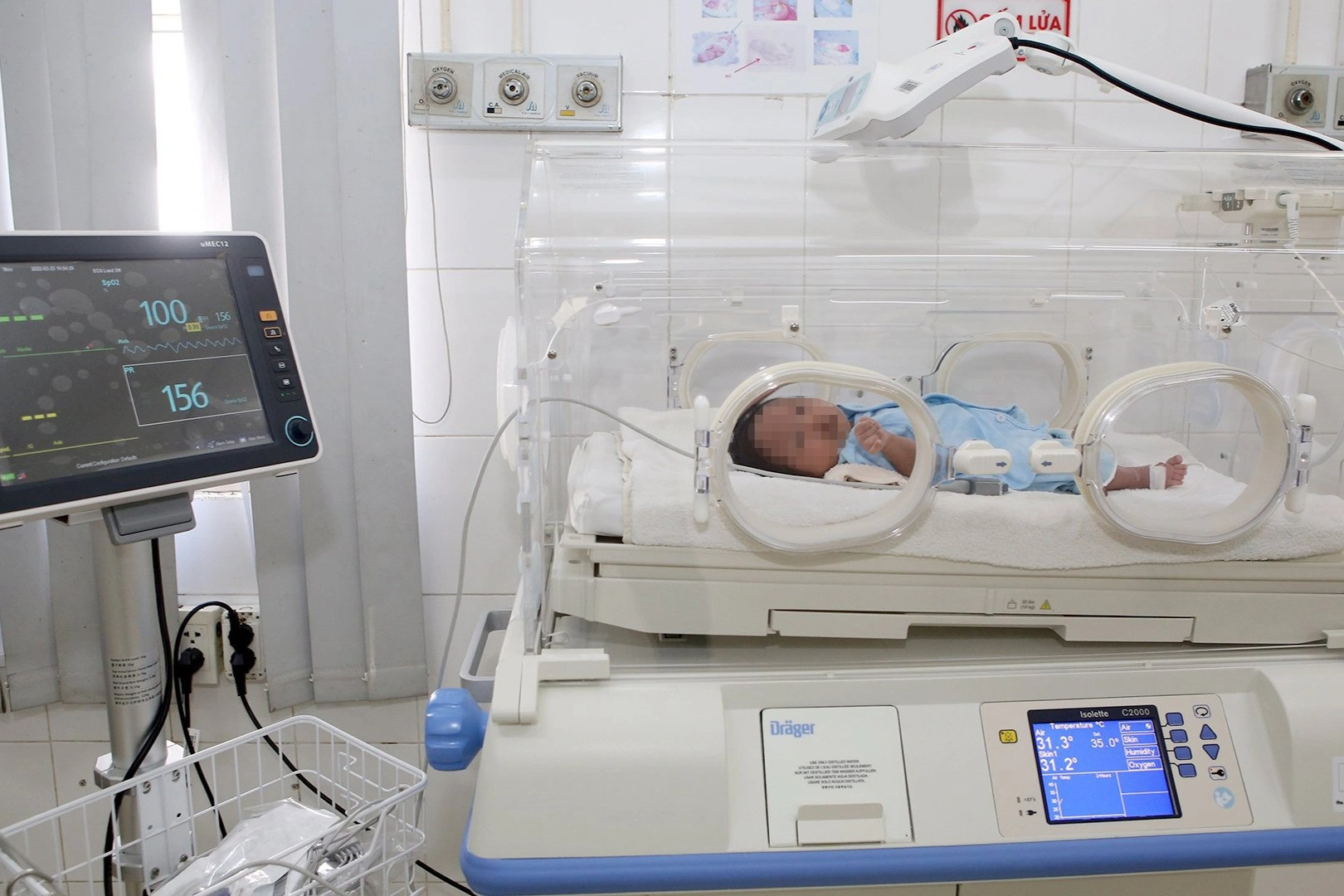 Một trẻ sơ sinh 22 ngày tuổi phình mạch não được cứu sống - 1