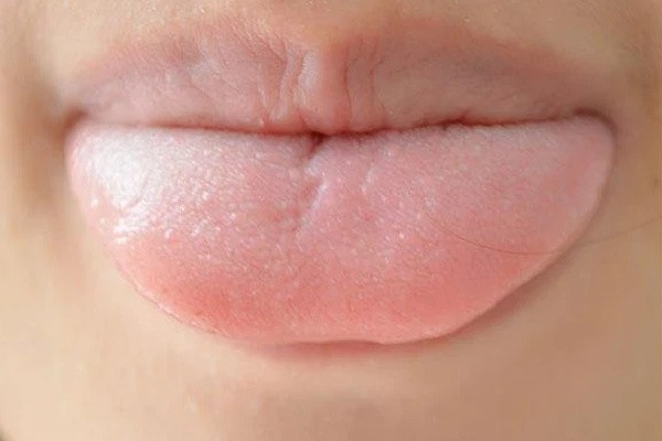 Nhìn lưỡi để biết sức khỏe, lưỡi có 4 thay đổi cho thấy bệnh tật đang xâm nhập vào cơ thể, cần đi khám kịp thời-1