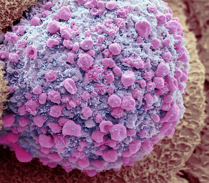 Các hạt của SARS-CoV-2 (màu xanh lam, tô màu minh họa) nảy chồi từ một tế bào ruột đang chết.