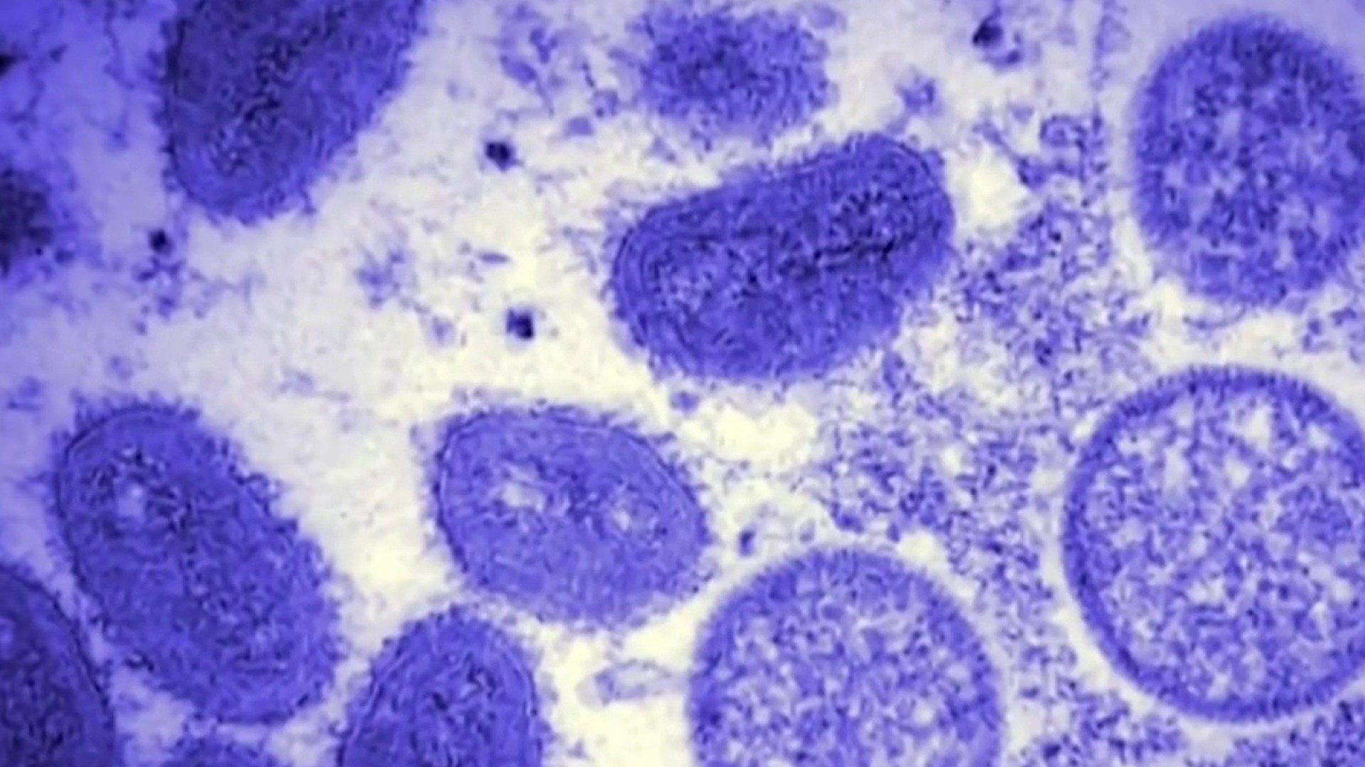 Virus đậu mùa khỉ có thể bám lâu trên các bề mặt trong nhà - 1