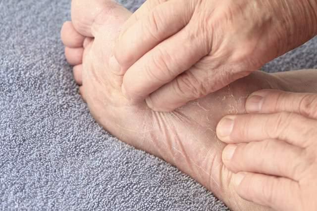 Có 4 dấu hiệu bất thường ở bàn chân, không phải lão hóa mà là những dấu hiệu của bệnh nguy hiểm-1
