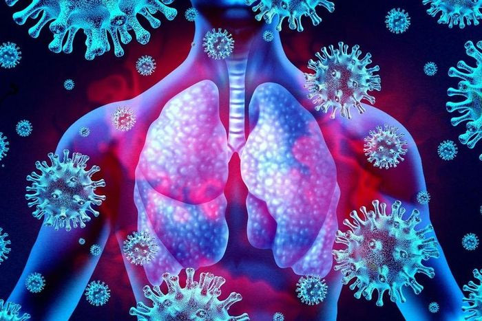 Đừng nhầm lẫn viêm phổi và viêm phế quản-1
